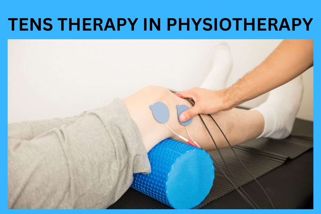 Read more about the article TENS Therapy In Physiotherapy-Best For Pain 2023