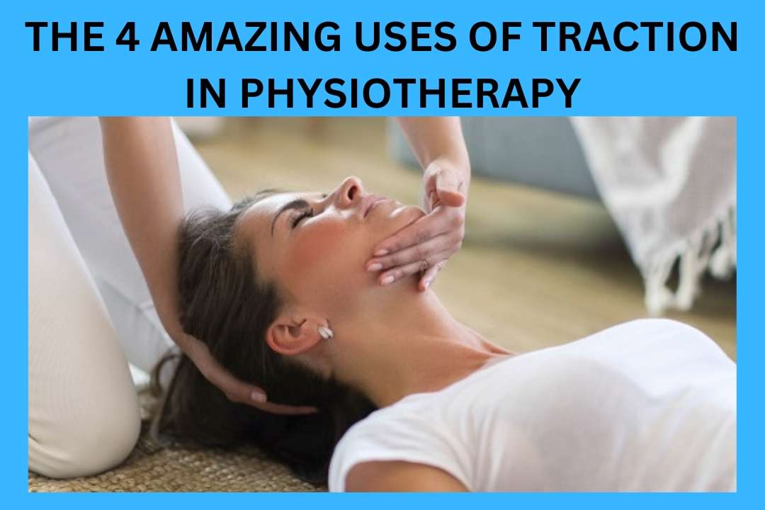 Read more about the article Traction In Physiotherapy-2024
