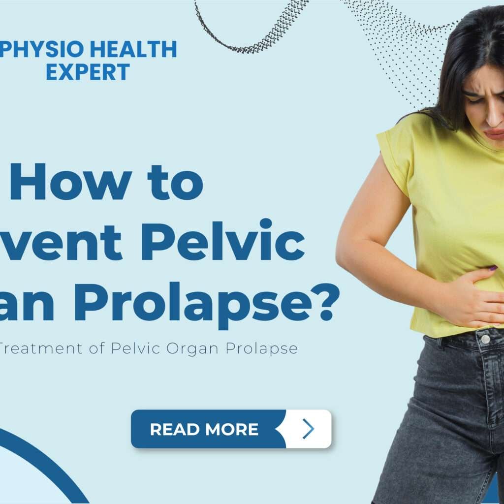 How to Prevent Pelvic Organ Prolapse