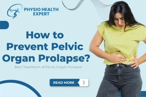 How to Prevent Pelvic Organ Prolapse